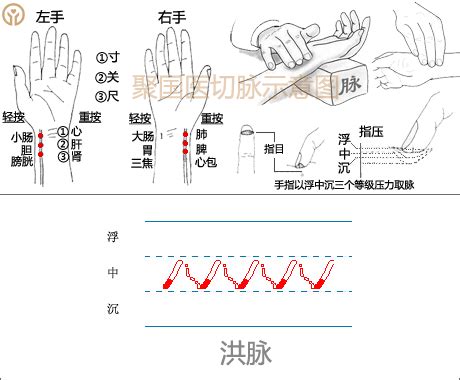 脈象圖|正常脈象